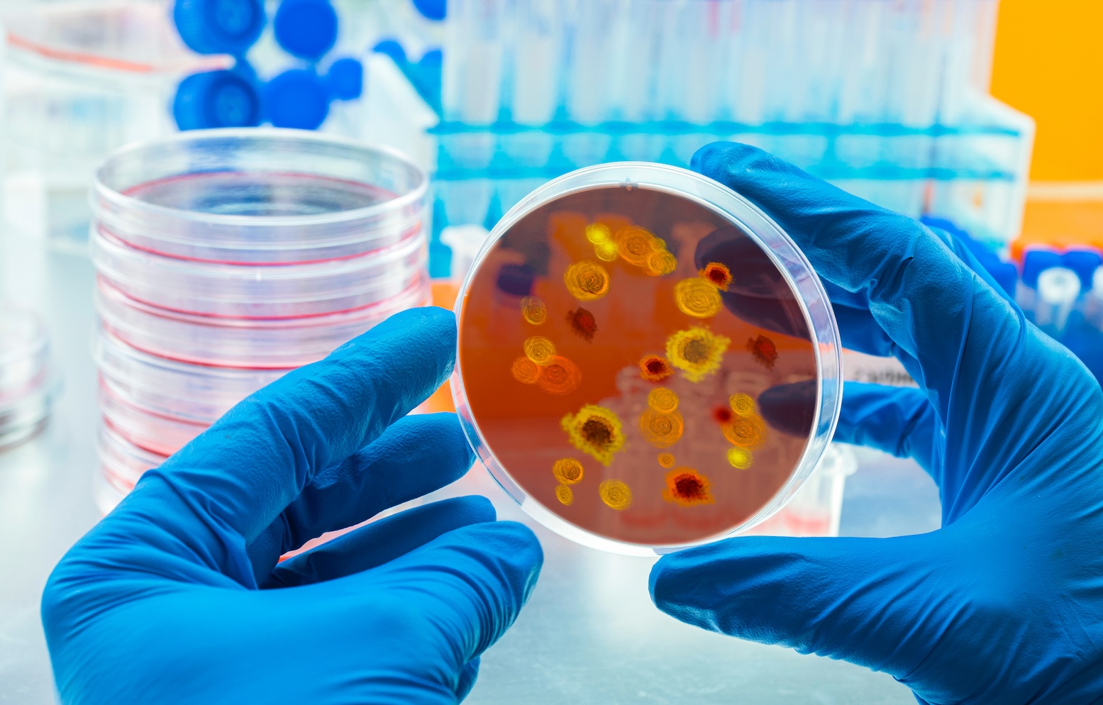 Komplikasi Akibat Dari Penurunan Trombosit