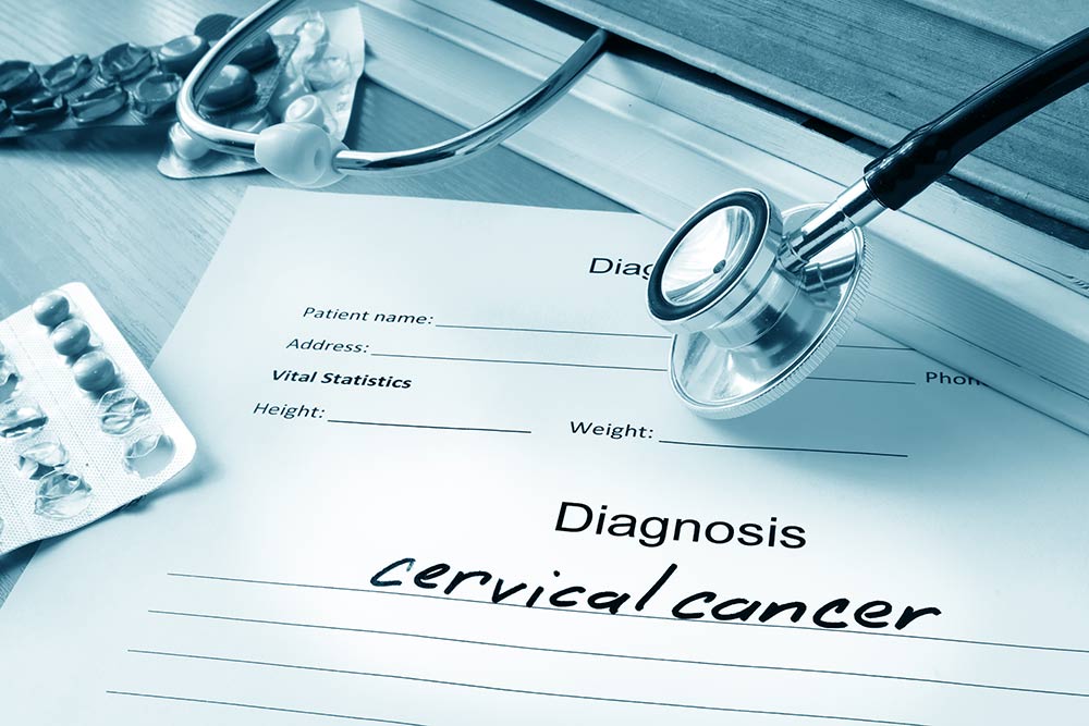 Faktor Penyebab Kanker Serviks